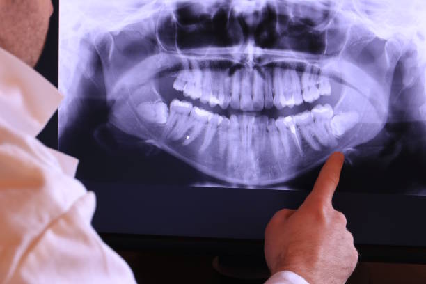 Best Emergency Dental Care for Broken or Chipped Teeth in Norristown, PA
