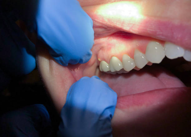 Best Emergency TMJ Treatment in Norristown, PA